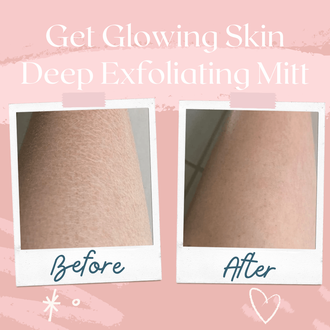 Traumhaut Peelinghandschuh | Entfernt abgestorbene Haut sanft | 50% RABATT HEUTE! - Skin Care - Default Title